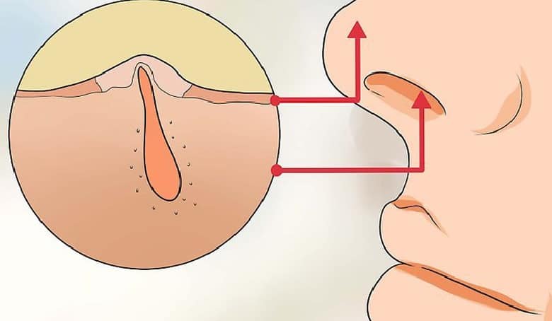 موی بینی را نباید از ریشه کند.