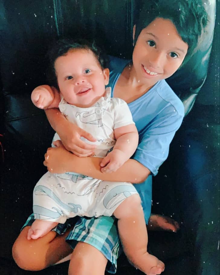 داستان زندگی نوزادی که با ناهنجاری ای با احتمال یک در میلیون به دنیا آمد