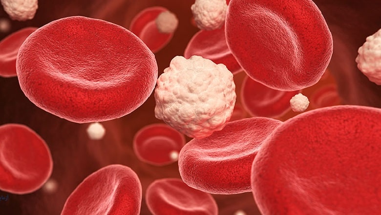 به داشتن قند خون شک کنید.