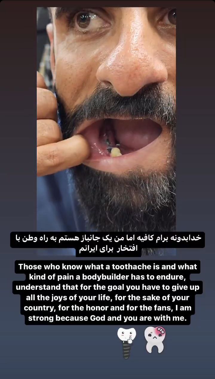  وضعیت عجیب و شوکه کننده دندان های هادی چوپان