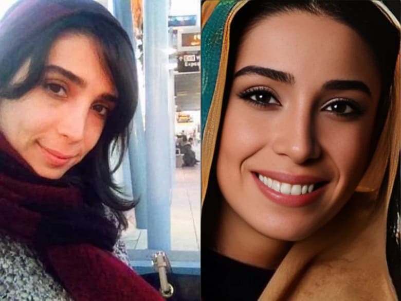 عاطفه نوری سریال نرگس با چهره‌ای کاملا متفاوت دیده شده بود.