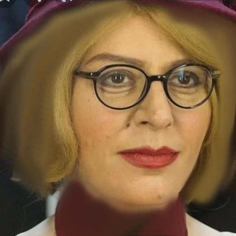 “سوسن پرور” چهره اش را به کلی شبیه اروپایی ها درست کرد/ عکس