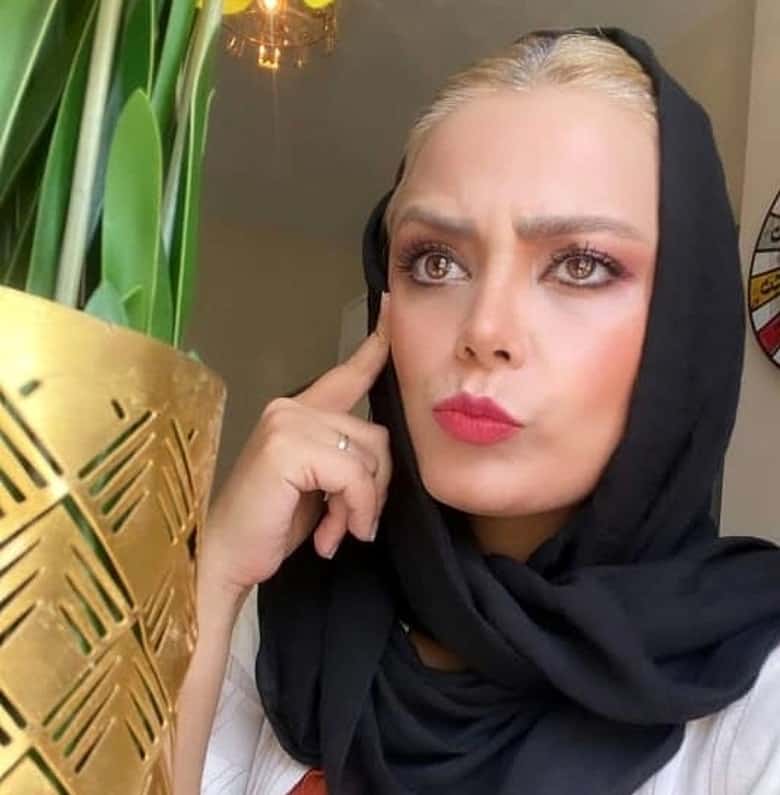 عکس/ مجری سابق تلویزیون به کلی چهره‌اش را تغییر داد!