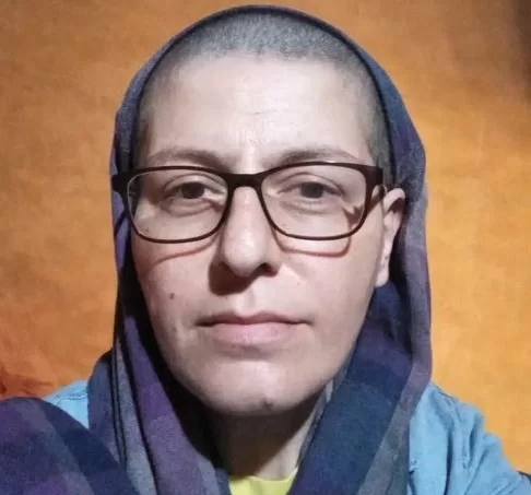 چهره باورنکردنی “سوسن ژرور” با موهای از ته تراشیده/ عکس