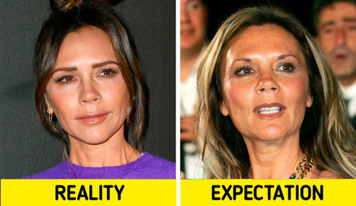 سلبریتی ها بدون عمل های زیبایی این شکلی بودند+عکس