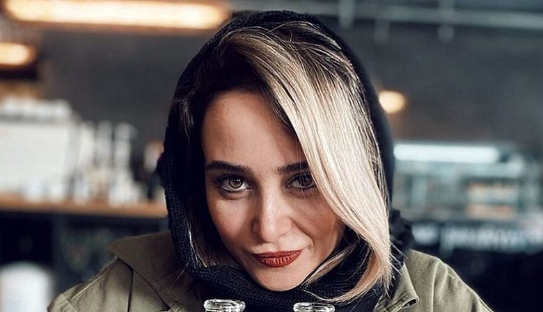 عکس/ آیا الناز حبیبی باز هم عمل کرده؟