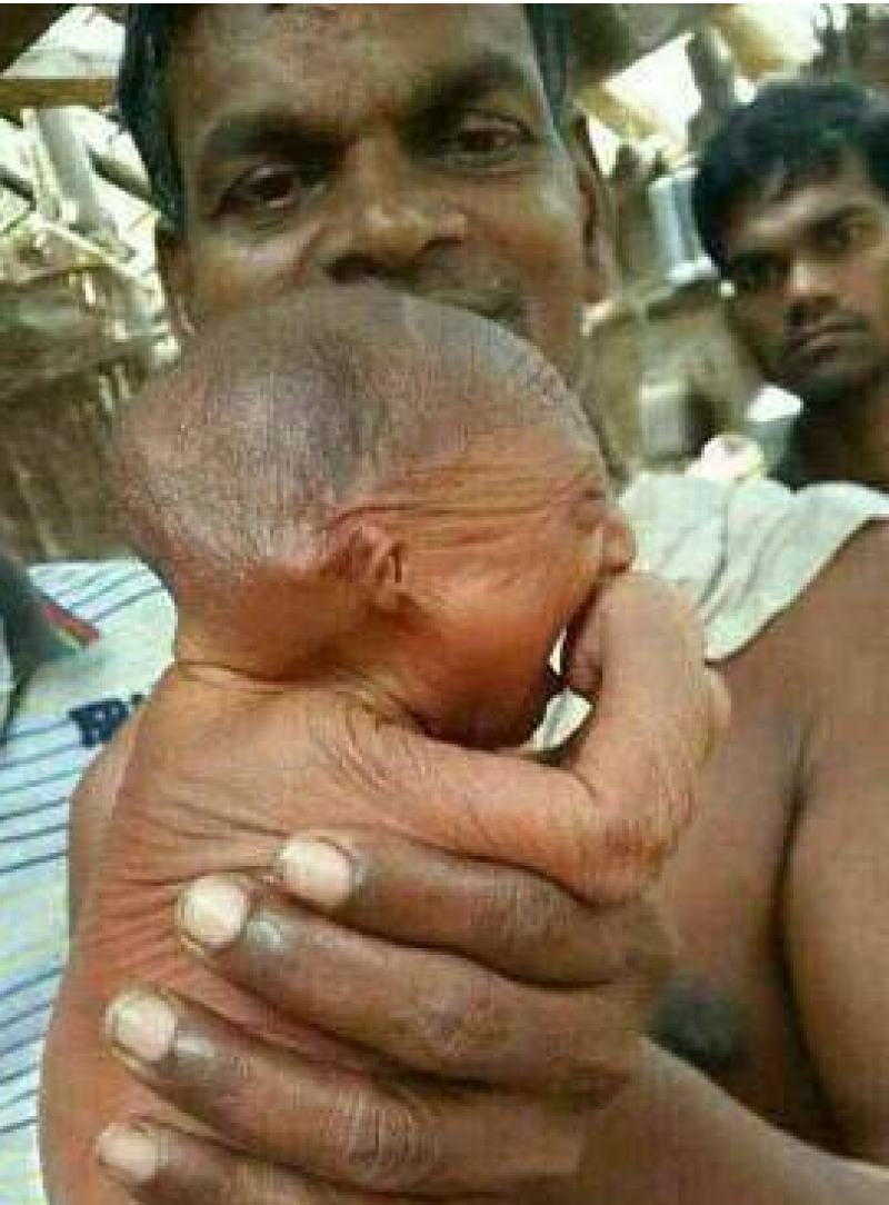 شوکه نشوید، این پیرمرد در حقیقت یک نوزاد است/ عکس