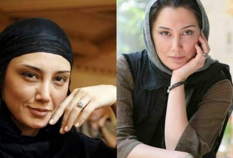 هدیه تهرانی عمل زیبایی نکرده است.