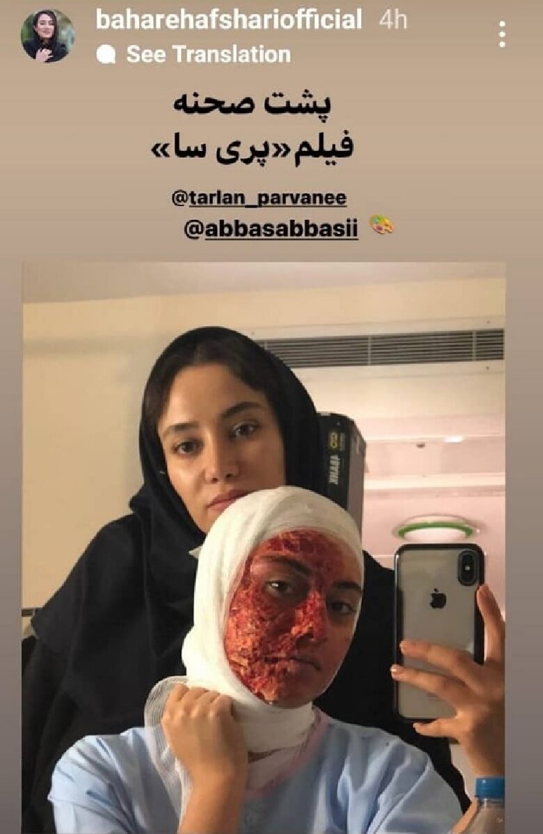 ترلان پروانه با صورتی سوخته و درب و داغان عکس گرفت.