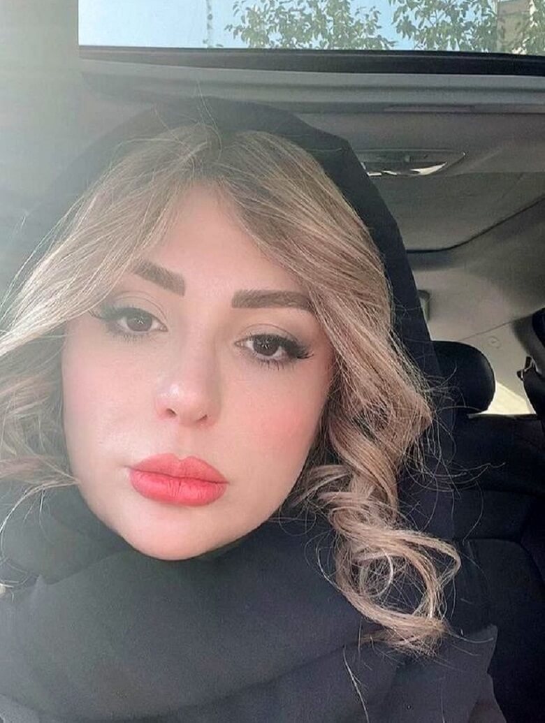 نیوشا ضیغمی چهره‌اش مصنوعی شد.