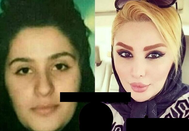 عمل‌های زیبایی بر چهره دنیا جهانبخت تاثیر دارد.